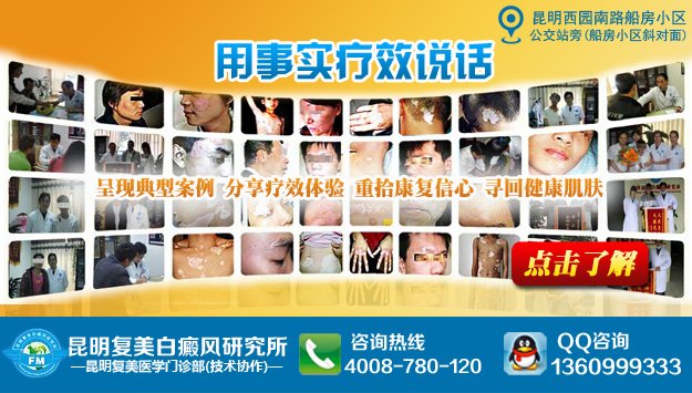 昆明白癜风皮肤病医院